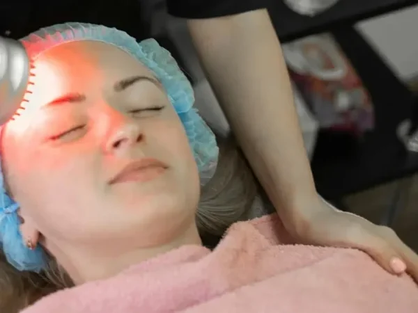 Aplicación de tecnología FHOS con luz roja para rejuvenecimiento facial