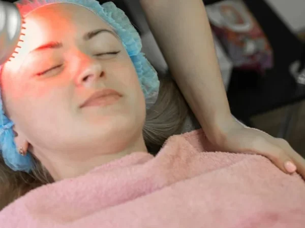 Aplicación de tecnología FHOS con luz roja para rejuvenecimiento facial