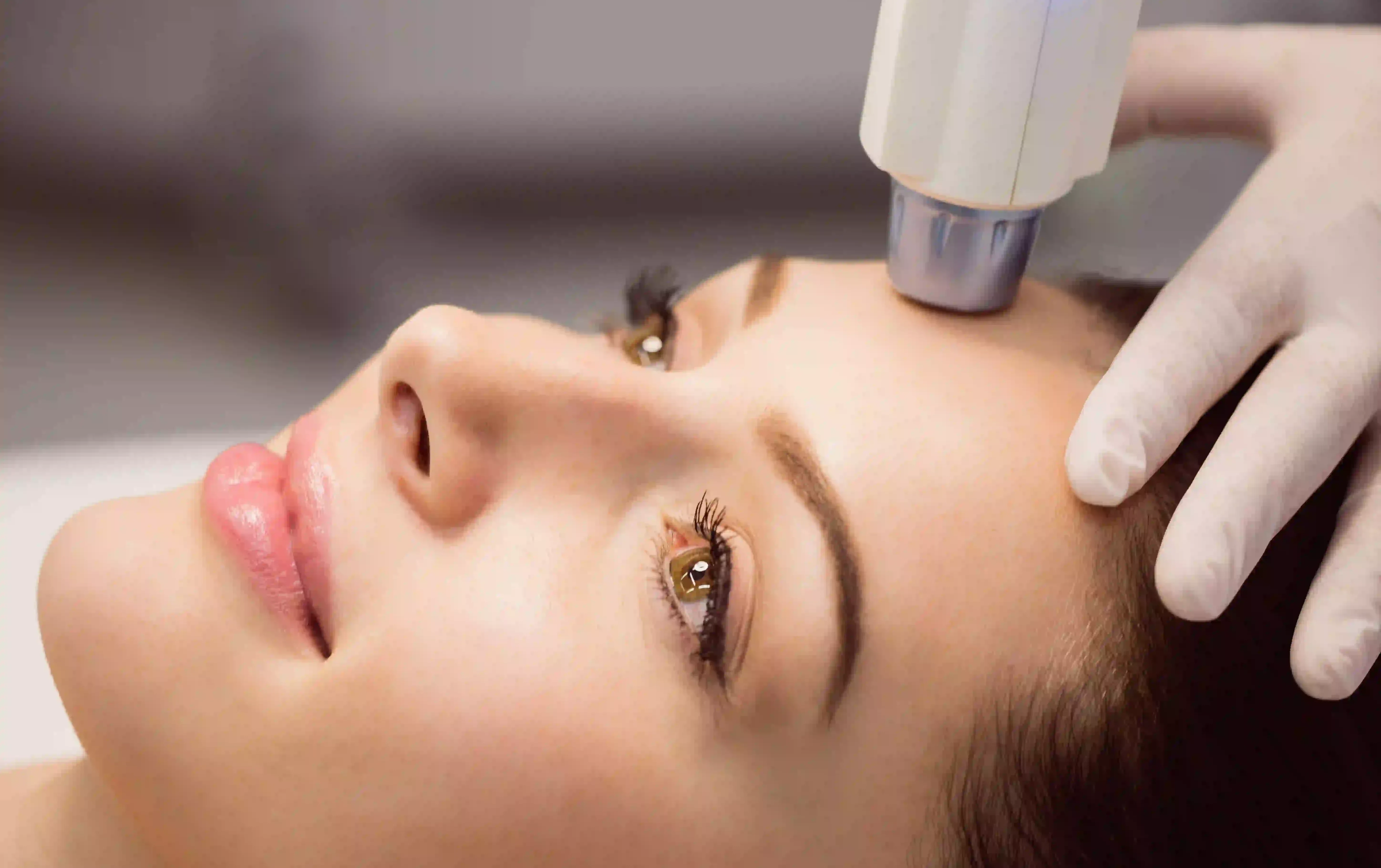 estimulo-termico-colageno-winback